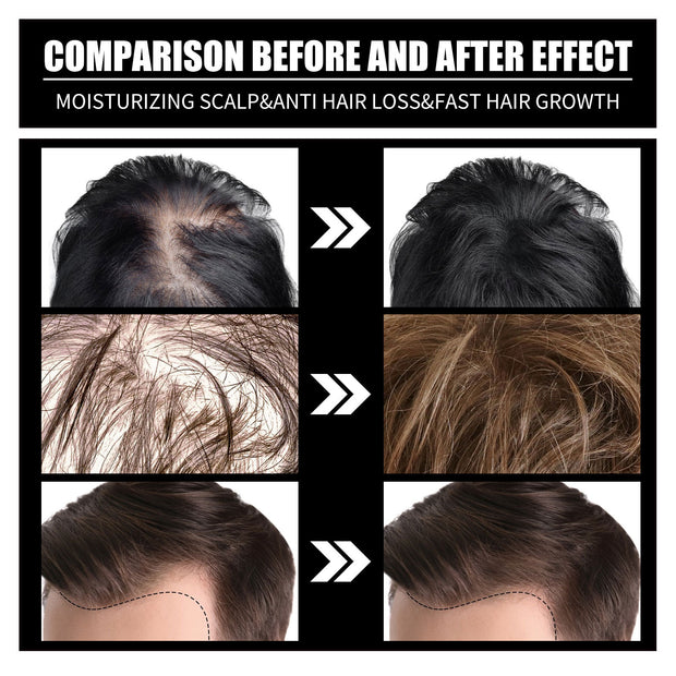 RESEARCH Liquid Biotin & Collagen Hair Growth Drops